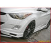 sequence quantum edition kit hyundai elantra 2010-13